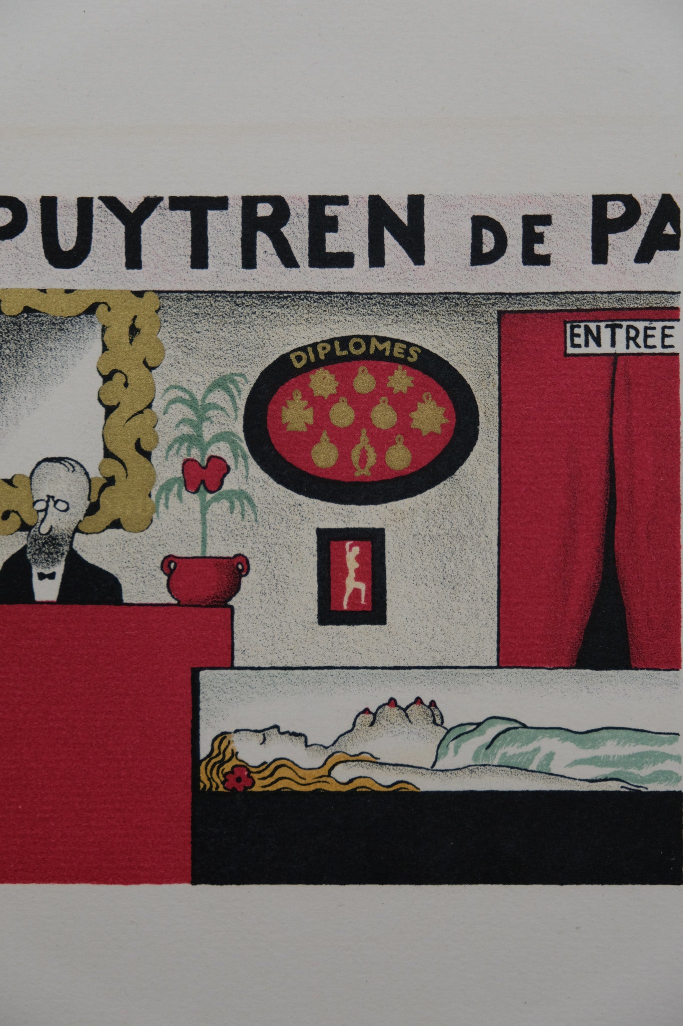 Lucien BOUCHER : Dupuytren - Lithographie originale